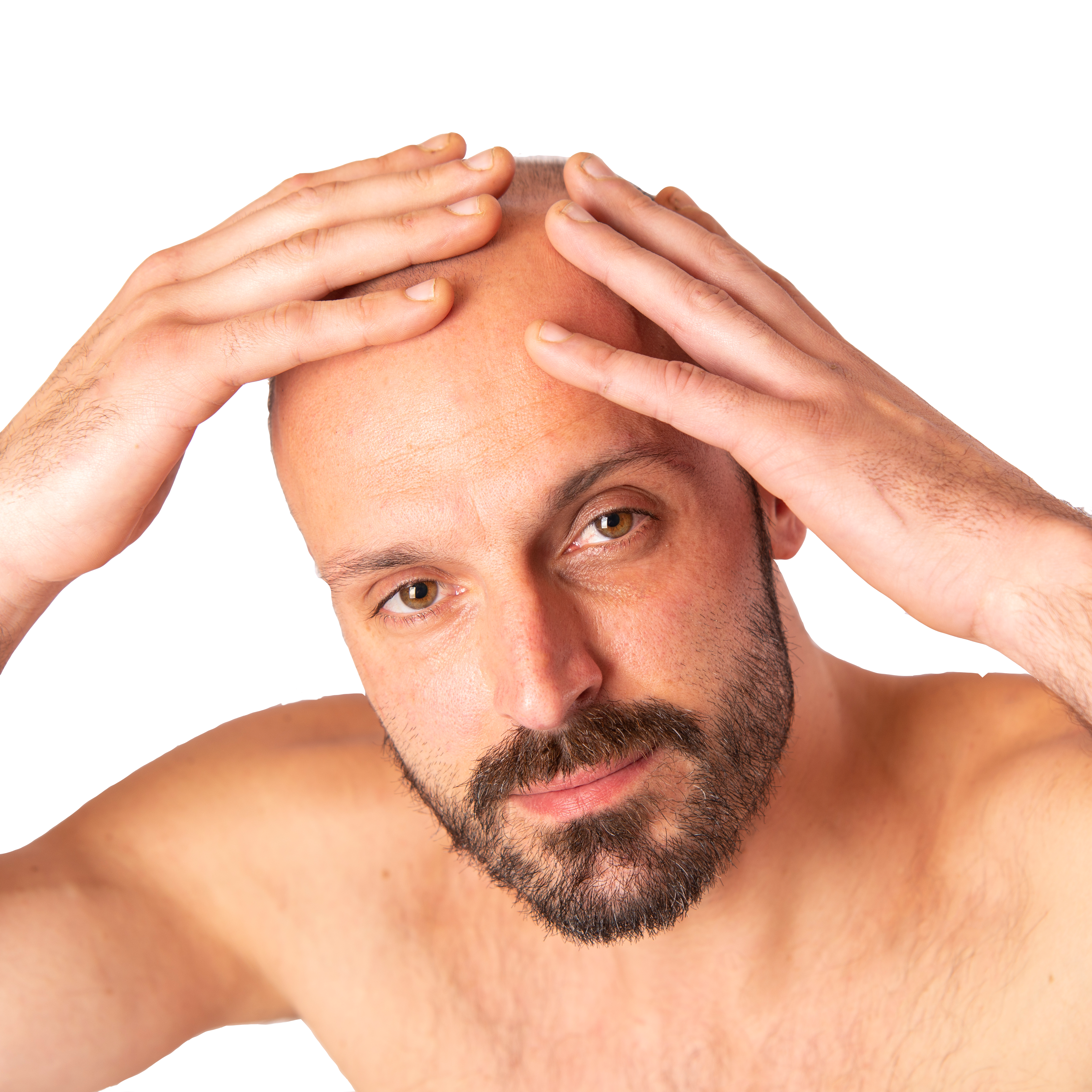 Hair transplant