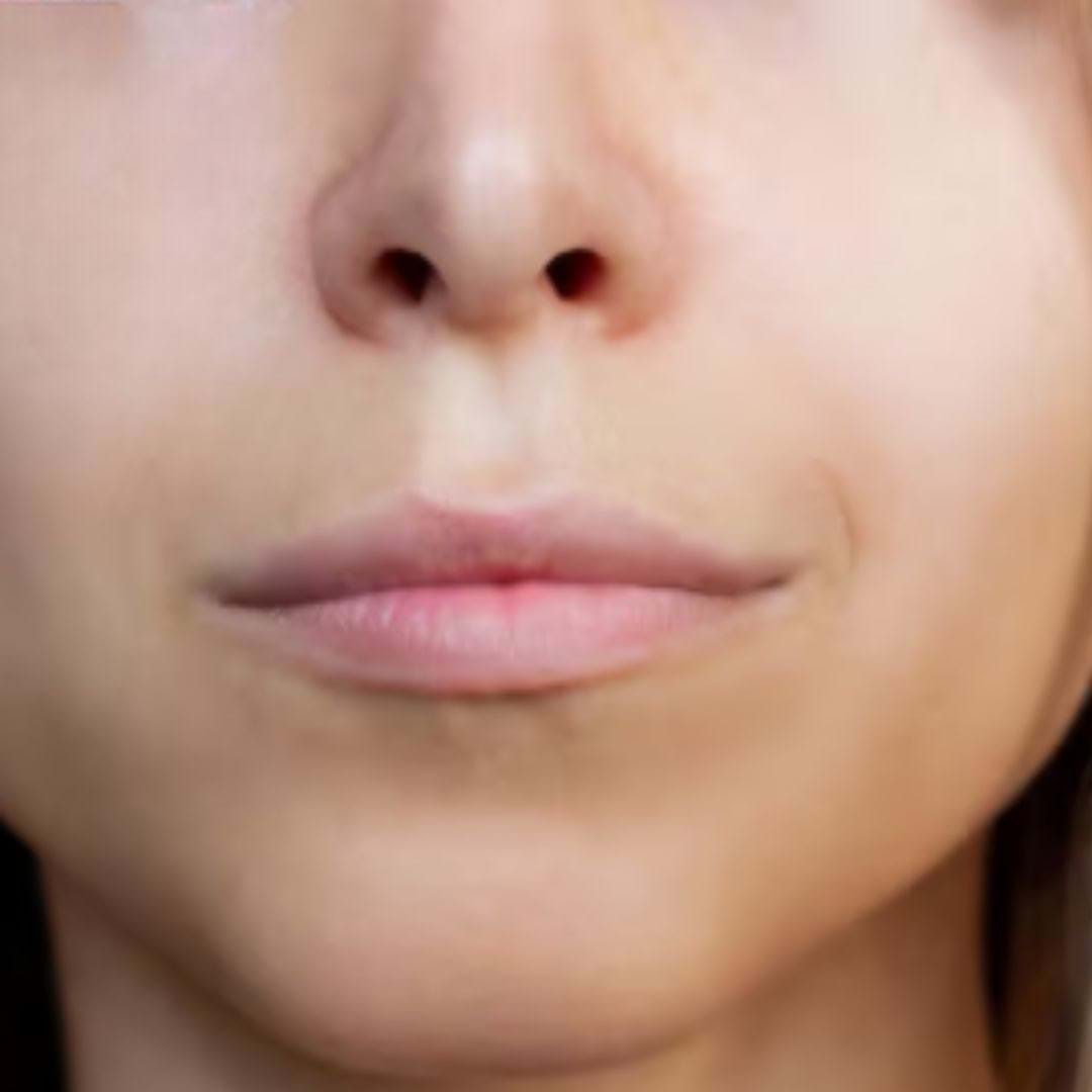 Nahaufnahme von Lippen vor der Lippenvergrößerung mit Füllern
