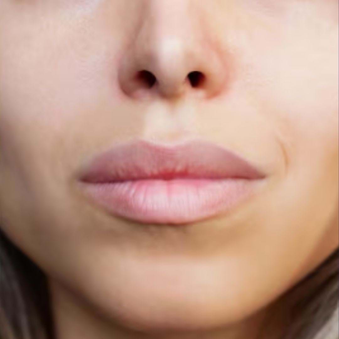 Gros plan des lèvres après Augmentation des levres avec produits de remplissage - fillers