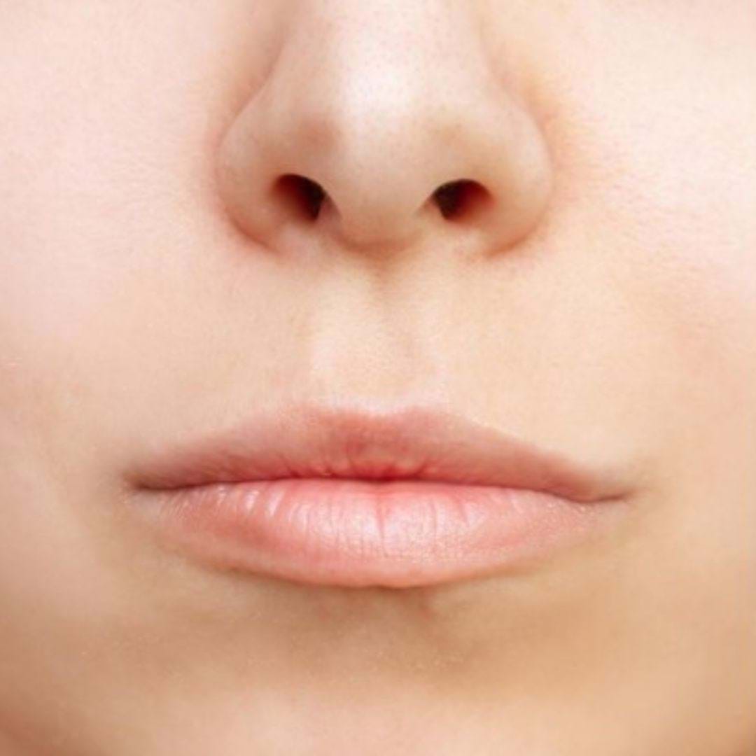 Frontaal beeld van het gezicht vóór de Lipvergroting met fillers