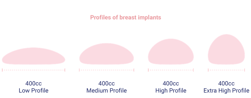 profil des implants mammaires