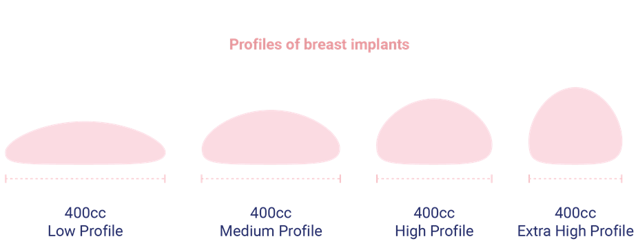 profile of breast implants