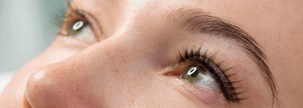 Eyebrow lift