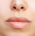 Frontal image of the face after lipfiller