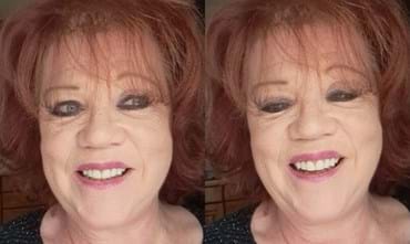 My Dental Journey at Wellness Kliniek with Dr. Jan Van Dijck